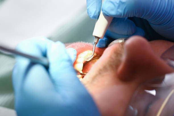Best Emergency Gum Treatment in Charleroi, PA